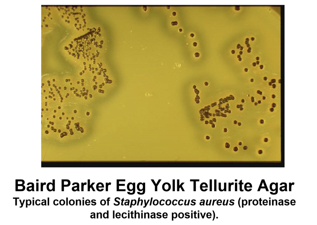 Staphylococcus BioScience Diagnostics Pte Ltd