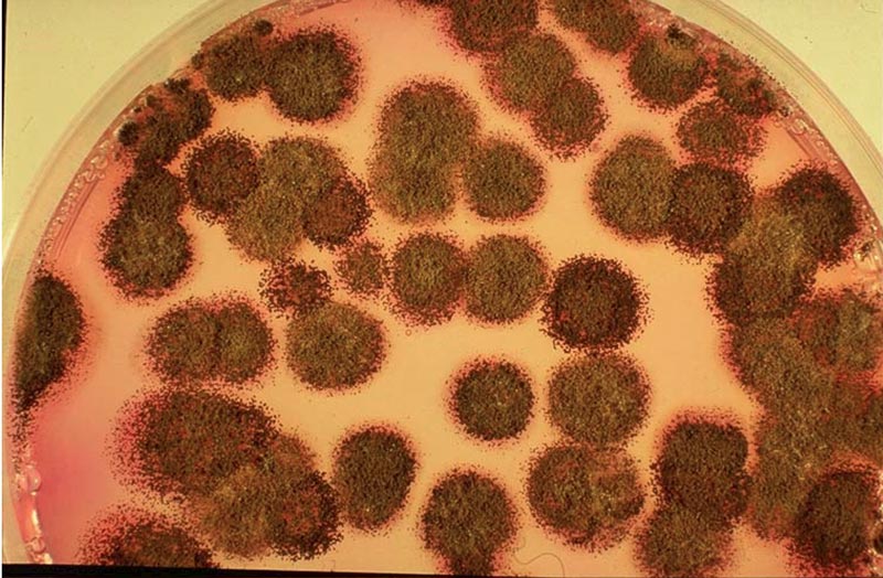 Yeast and Mold BioScience Diagnostics Pte Ltd