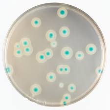 1) Pic 4_Bacillus Cereus